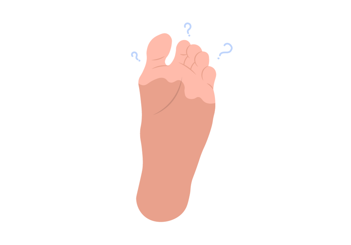 Má circulação: quando o sangue não flui corretamente para os pés, pode ocorrer formigamento, especialmente quando a pessoa está em pé ou sentada por longos períodos de tempo. Neuropatia periférica: esta é uma condição em que os nervos dos pés são danificados, causando formigamento e outros sintomas como dor e fraqueza muscular. Diabetes: pacientes diabéticos têm maior probabilidade de desenvolver neuropatia periférica, o que pode levar ao formigamento nos pés. Esclerose múltipla: esta é uma condição autoimune em que o sistema imunológico ataca a mielina, a camada protetora dos nervos, causando sintomas como formigamento e fraqueza muscular. Hérnia de disco: quando uma hérnia de disco pressiona os nervos da coluna vertebral, pode ocorrer formigamento nos pés e outras partes do corpo.